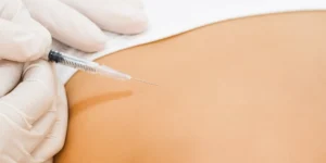 Carboxiterapia - Clínica Fisioderme em Brasília / DF - Candangolândia e Asa Sul