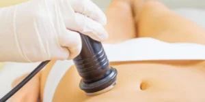 Lipocavitação - Clínica Fisioderme em Brasília / DF - Candangolândia e Asa Sul