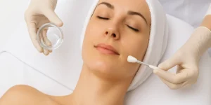 Peeling Químico - Clínica Fisioderme em Brasília / DF - Candangolândia e Asa Sul