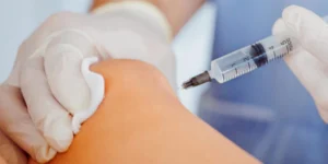 Resultado da secagem de vasinhos nas pernas em clínica de Brasília
