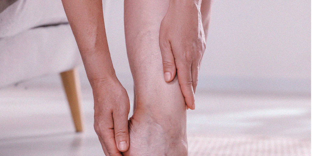 Imagem explicativa das diferenças entre varizes, microvarizes e vasinhos (telangiectasias) com tratamento indicado em Brasília