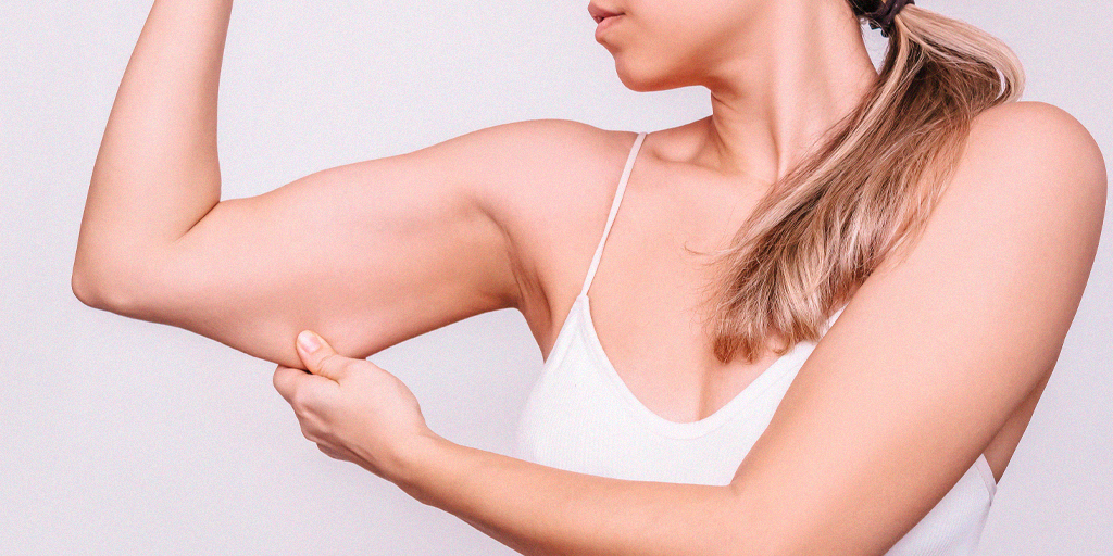 Mulher mostrando braços firmes após tratamento contra flacidez