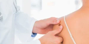 Paciente em clínica dermatológica realizando remoção de sinal a laser com dermatologista especialista