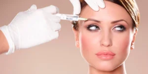 Resultado do tratamento de rugas na glabela antes e depois na Fisioderme Brasília DF