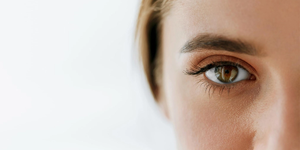 Siringoma nas Pálpebras - Clínica Fisioderme em Brasília / DF - Candangolândia e Asa Sul