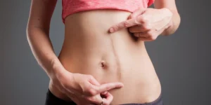Tratamento de cicatriz deprimida antes e depois com resultados reais