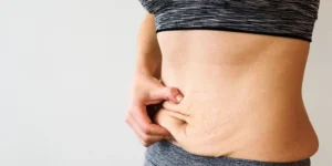 mulher com diástase abdominal em avaliação fisioterapêutica