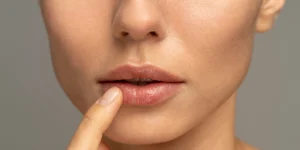 Antes e depois do tratamento com Skinbooster caneta pressurizada para lábios