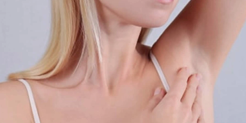 Hidradenite Supurativa ou Acne Inversa - Clínica Fisioderme em Brasília / DF - Candangolândia e Asa Sul