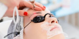 Mulher em clínica estética realizando despigmentação de sobrancelha a laser com equipamento PICOSURE.