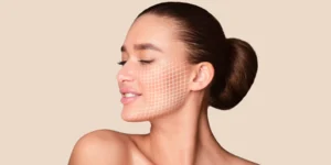 Jato de Plasma para Rejuvenescimento Facial em Brasília DF – Clínica Fisioderme - Asa Sul e Candangolândia