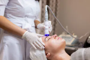Mulher tratando com Laser Lavieen a face