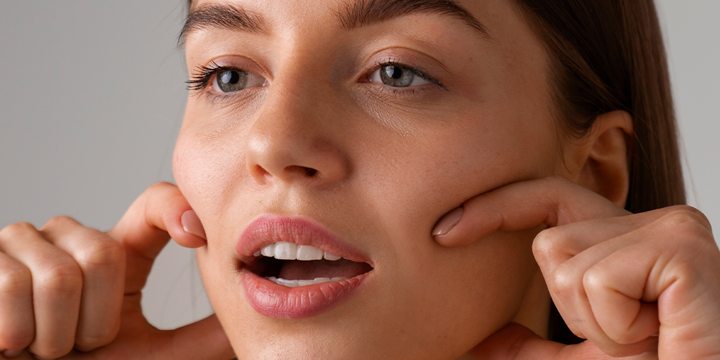 resultado do cornerlift elevando cantos da boca em brasilia