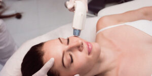 Tratamentos com diferentes tipos de laser utilizados na Clínica Fisioderme para pele, manchas e rejuvenescimento