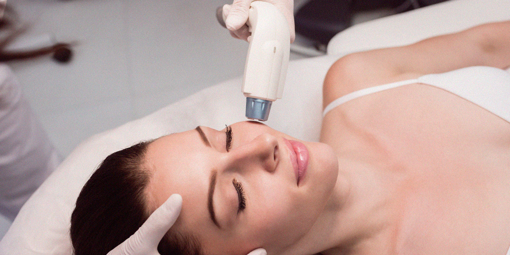 Tratamentos com diferentes tipos de laser utilizados na Clínica Fisioderme para pele, manchas e rejuvenescimento