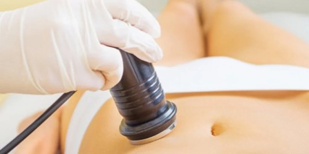 Lipocavitação - Clínica Fisioderme em Brasília / DF - Candangolândia e Asa Sul